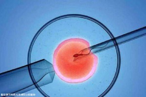 供卵联系方式